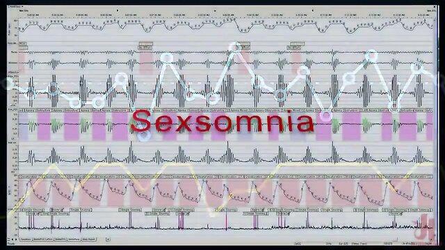 Amilia Onyx Dreams of Sultry Trans Lesbian Nurse Kayleigh Coxx