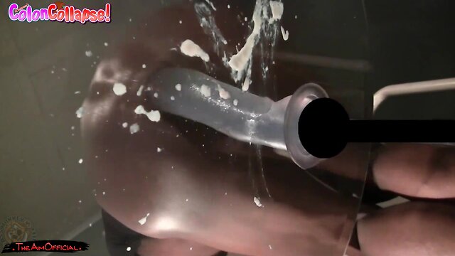 How my colon collapsed - butt monkey just loose after too much anal sex